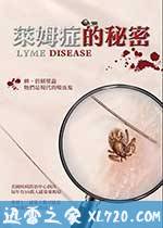 莱姆症的秘密 (2017)